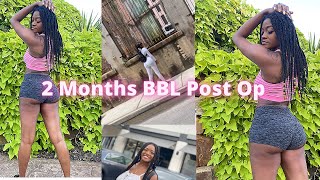 Bbl Journey L 2 Months Post Op l Body Reveal Qu0026al Mia Aesthetics