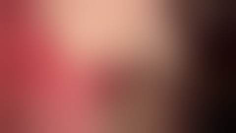 Segment 1 liver resection