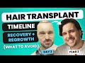 What to Expect for Your Hair Transplant Recovery: A Journalist Explains