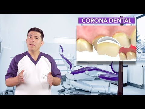 🚨 ¿Sabes qué es una CORONA DENTAL? 🧐