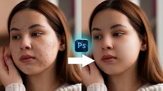 Master Skin Retouching in Photoshop (2024) ✅