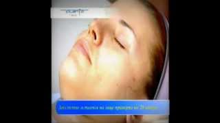 Микроигольчатая мезотерапия (Valento-Plazan).wmv(Микроигольчатая мезотерапия с помощью V-роллера. Подробный ход процедуры. Замечательные результаты показ..., 2011-07-04T13:56:41.000Z)
