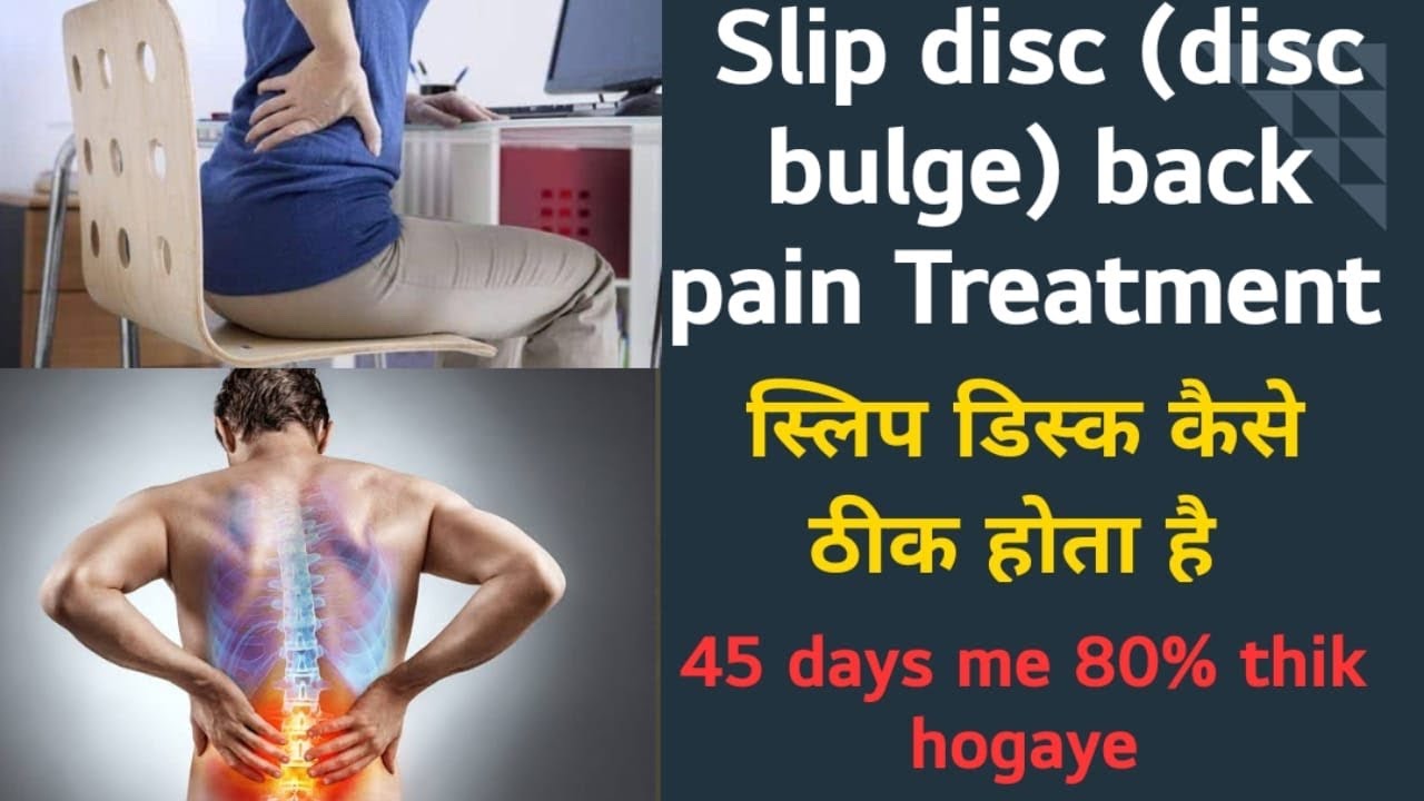 Slip disc kaise thik hoti hai is video me dekhiye slipdisc discbulge sciatica YouTube