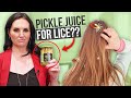 Pickle Juice for HEAD LICE REMOVAL?? Watch BEFORE you try...