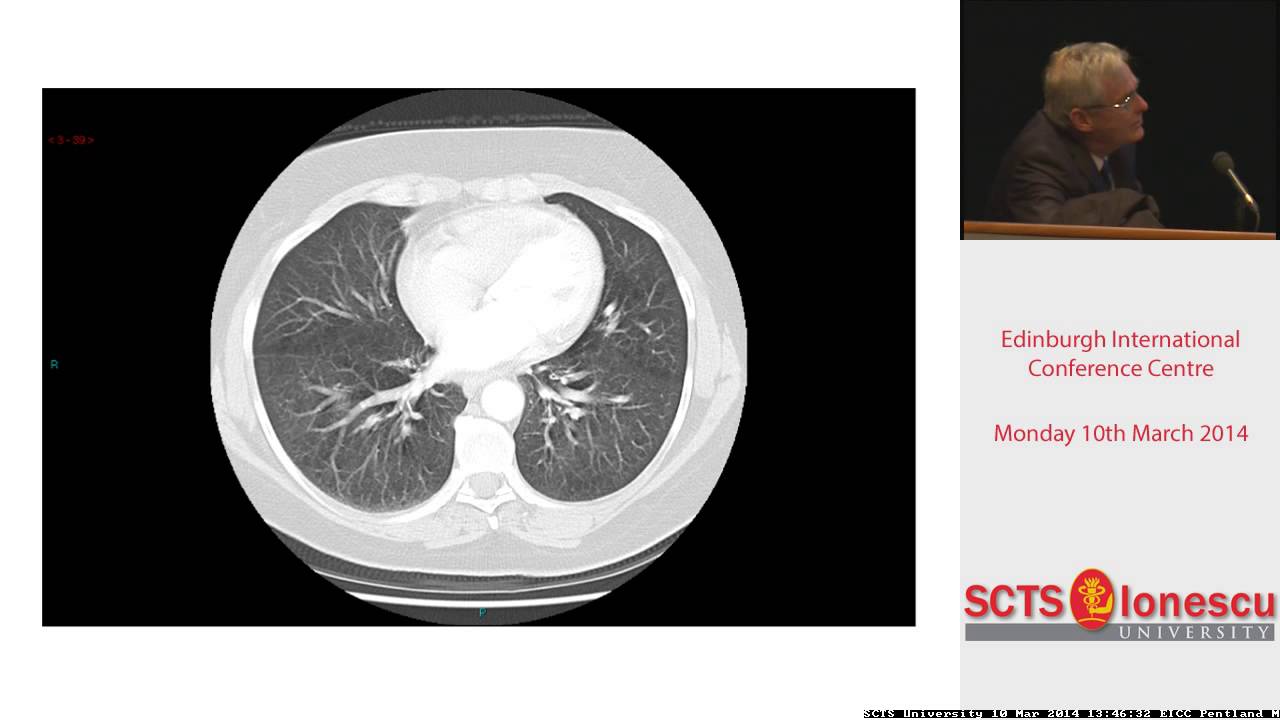 emphysema case study examples