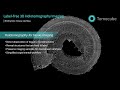 Embryonic mouse cochlea - Label-free 3D imaging by Holotomography