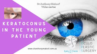 Dr Anthony Maloof Keratoconus In The Young Patient At Eyes Faces