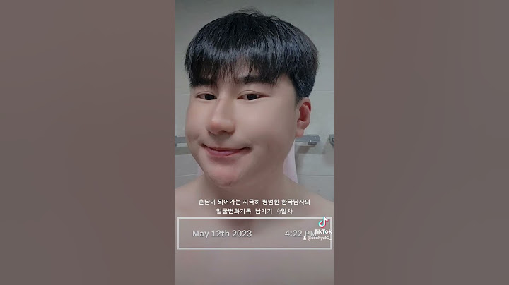 훈남이 되어가는 지극히 평범한 한국남자의 얼굴변화기록 남기기 41일차