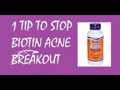 # Tip To Stop Biotin Acne Breakout