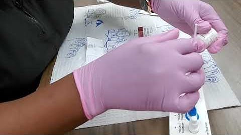 Dipstick Strep A Test