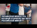 Медсестре из Лисичанска оторвало обе ноги. Она вышла замуж в больнице