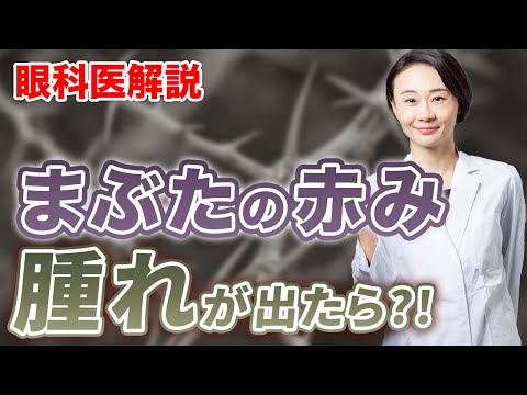 眼科医解説！『目のまぶたの赤みや腫れがでたら？』