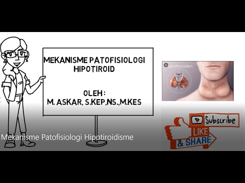 Mekanisme Patofisiologi Hipotiroidisme