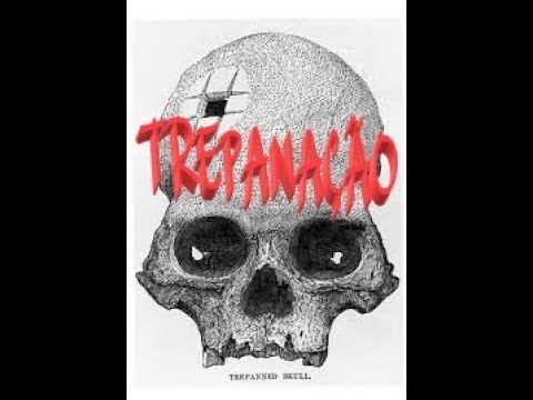 Vídeo: O que a trepanação faz?