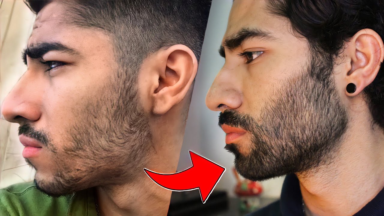 Este TRUCO DUPLICA tus Ganancias de BARBA con Minoxidil