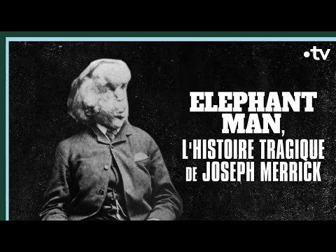 Vidéo: L'homme éléphant Joseph Merrick : une histoire de vie