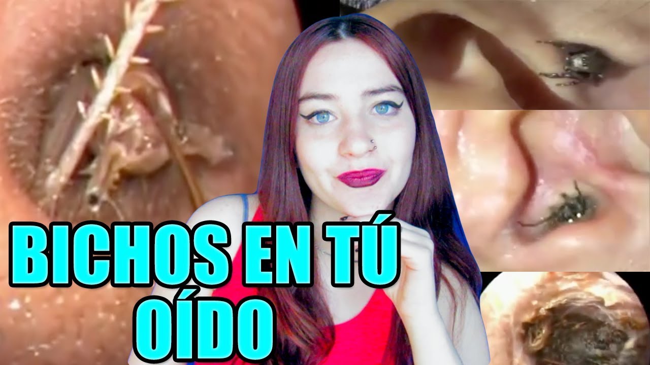 BICHOS EN TU OÍDO