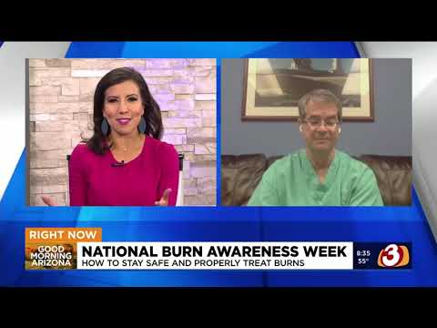 National Burn Awareness Week