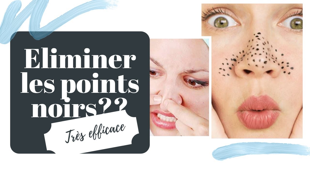 Comment j'ai éliminé mes points noirs avec seulement 02 ingrédients