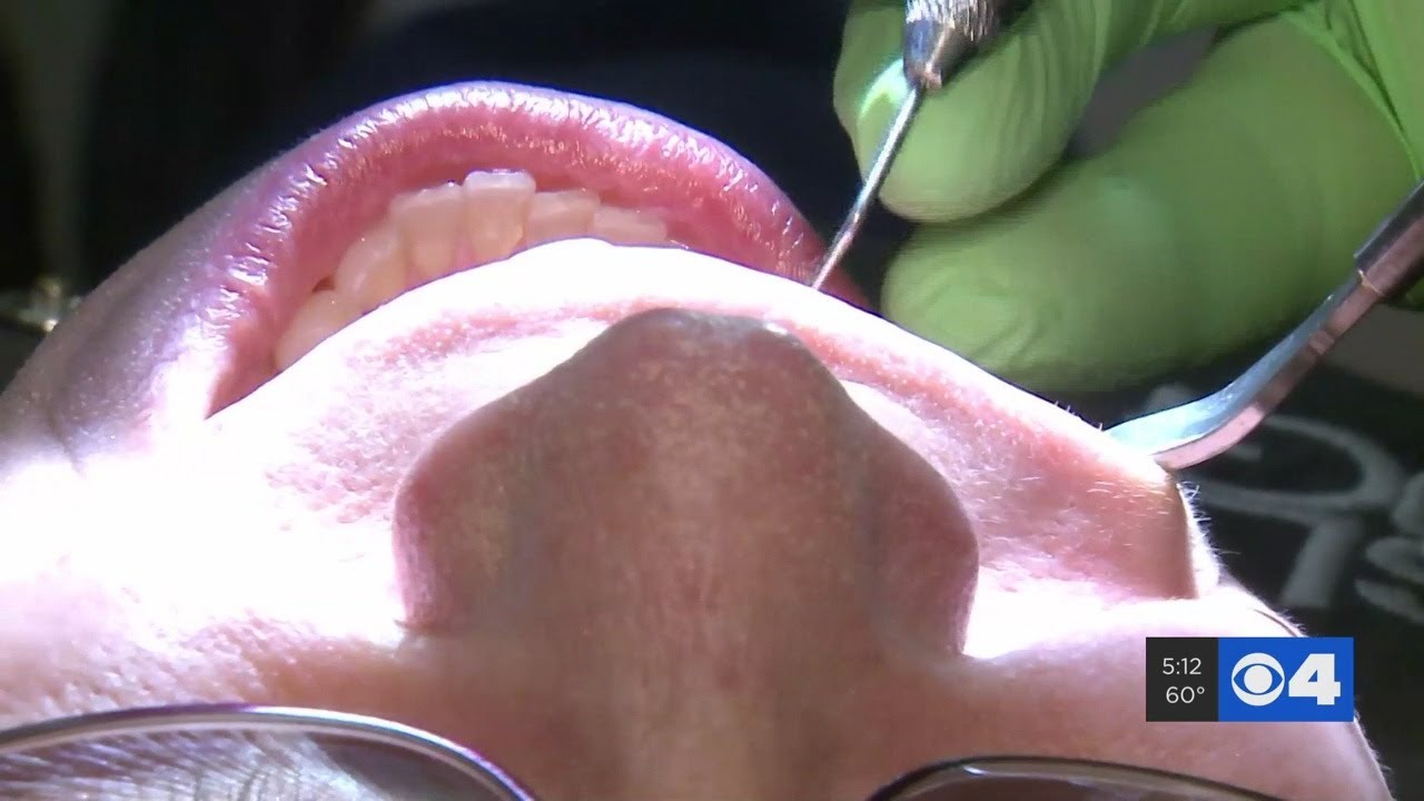 Some dentists limit non-emergency visits due to COVID-19 concerns