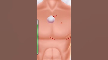 how to see  put heart pacemaker with #3danimation #doctor #shortsvideo