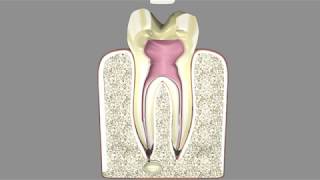 Laser Root Canal screenshot 5