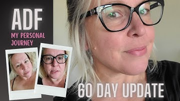 Alternate Day Fasting for 60 DAYS! ADF Weight Loss Journey and Results