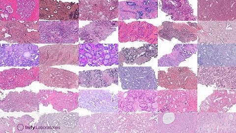 Why is image quality so important?