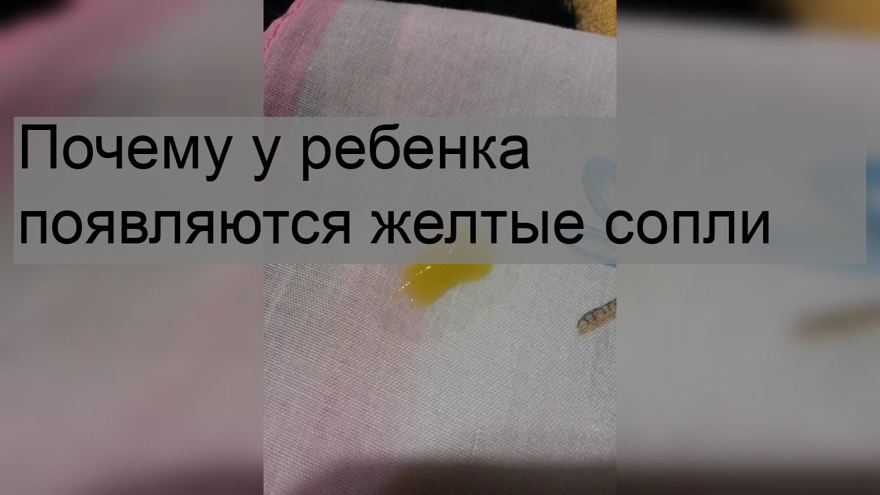 Ярко жёлтые сопли у ребёнка. Жёлтые сопли у взрослого без температуры. Почему желтые сопли у взрослого