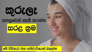 Pimples Treatment How To Remove Pimples Easy කරල සවකරගම I Kurule Walata Prithikara 2021