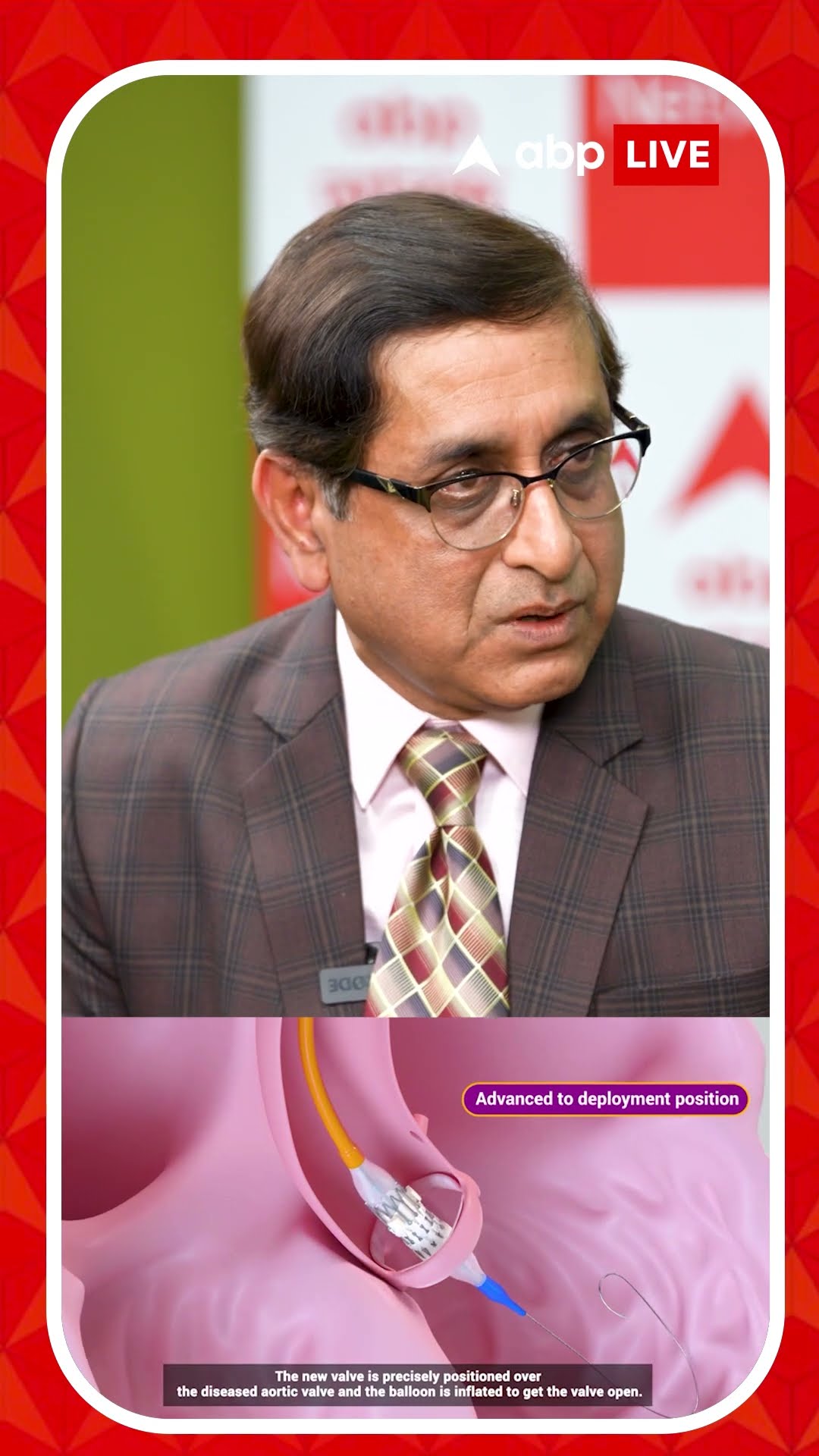 Transcatheter Aortic Valve Implantation : বুক কাটতে হয় না, দেড়ঘণ্টার অপারেশন, তাড়াতাড়ি বাড়ি ফেরা