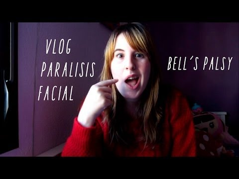 Vlog | Paralisis Facial | Bell´s Palsy