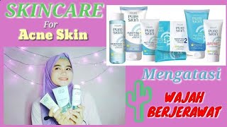 MY ACNE STORY - Perjuangan melawan jerawat pakai 1 produk :')