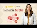 Ischemic Stroke | Neurology Medicine Lectures | Student Education | V-Learning | sqadia.com