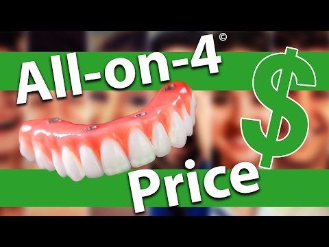 all-on-4-dental-implants-cost