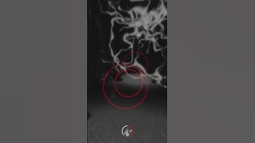 Most skill SCP SL Players | SCP Secret Lab