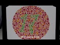 videoslide buku tes buta warna 38 plate | Ishihara color deficiency test 38 Videoslide