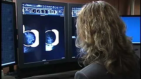 New Tool Helps Doctors Detect Breast Cancer Soon