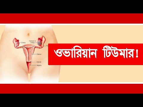 Ichinose ameri pornosini onlayn tomosha qiling