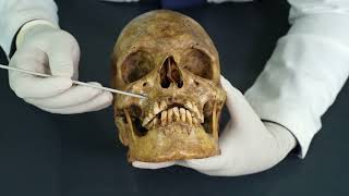 Famous Norma frontalis Profile