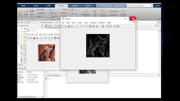 Laplacian of Gaussian