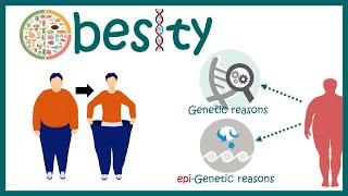Obesity | Causes  of Obesity | Diagnosis and Treatment of Obesity | Obesity treatment