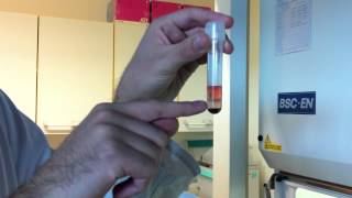 5Résultats Ficoll, Différentes Couches