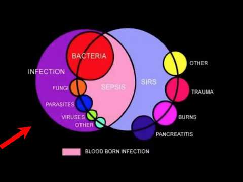 Video: Sepsis - Sepsiksen Syyt Ja Oireet