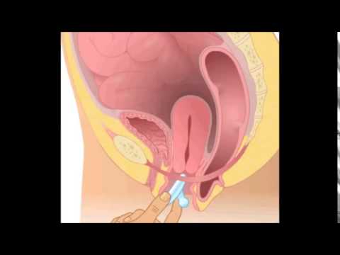 Image Result For You Tube Ovj Image Result For You Tube Ovj