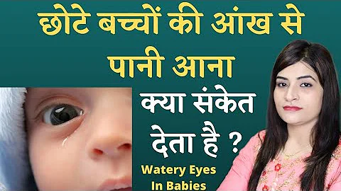 क्या आपके बच्चे की आँखों से पानी आ रहा है | Watery Eyes in babies | Blocked Tear Duct in Babies
