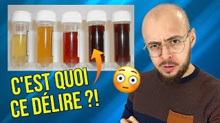 Que cache la COULEUR de votre URINE ?!