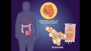 Sotorasib plus Panitumumab in KRAS-Mutated Colorectal Cancer | NEJM