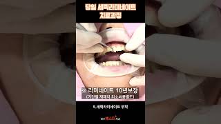 대구 당일 세렉라미네이트 2개치료과정!! (대구예스타치과) #shortsvideos #대구예스타치과