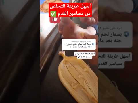 أسهل طريقة للتخلص من مسامير القدم الصحة القدم معلومات ثقافة الشفاء   الموز سبحان الله 4